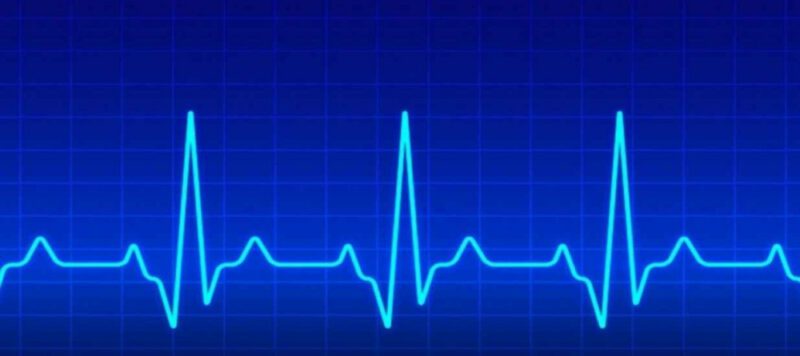 EKG Nedir EKG (Elektrokardiyografi) Nedir? EKG Neden Çekilir? EKG Nedir EKG (Elektrokardiyografi) Nedir? EKG Neden Çekilir?