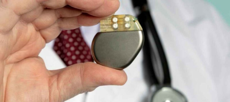 Kalp Pili Implantasyonu Kalp Pili Nedir? Kalp Pili Neden ve Nasıl Takılır? Kalp Pili Implantasyonu Kalp Pili Nedir? Kalp Pili Neden ve Nasıl Takılır?