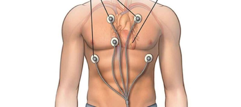 Ritm Holter Holter Nedir? Nasıl Takılır? Ritm Holter Holter Nedir? Nasıl Takılır?
