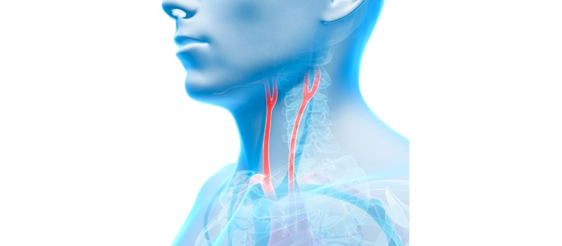 Karotis Arter Darligi Karotis Arter Darlığı: Nedenleri, Belirtileri ve Tedavisi Karotis Arter Darligi Karotis Arter Darlığı: Nedenleri, Belirtileri ve Tedavisi