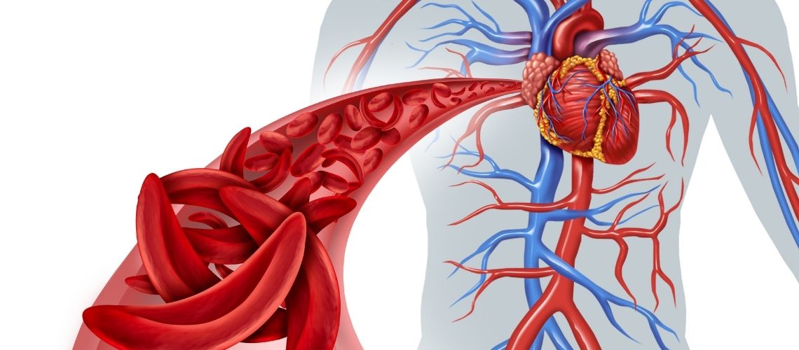 Kan Dolasimi Nedir Kan Dolaşımı Nedir? Büyük ve Küçük Kan Dolaşımı Nasıl Gerçekleşir? Kan Dolasimi Nedir Kan Dolaşımı Nedir? Büyük ve Küçük Kan Dolaşımı Nasıl Gerçekleşir?
