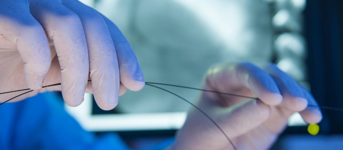 Kalp Stent Taktiranlarin Yorumlari Sikayetleri Kalp Stent Taktıranların Yorumları & Şikayetleri
