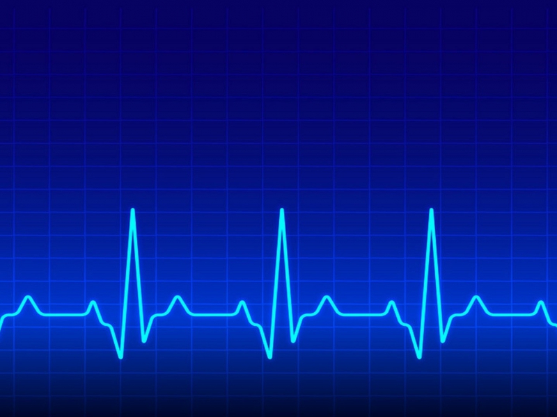 EKG Nedir?